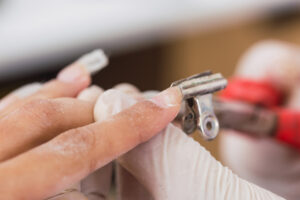 Mechaniczne uszkodzenie macierzy paznokcia – objawy i leczenie